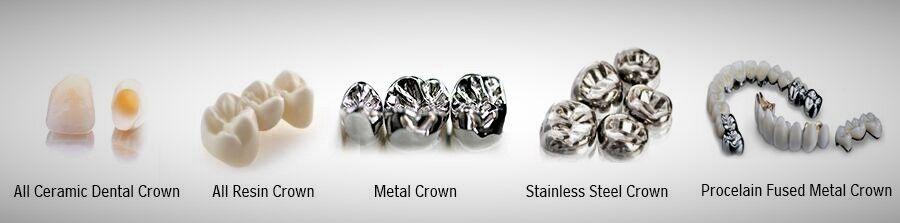 Dental Crowns