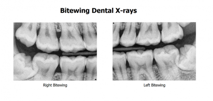 Digital-Dental-Radiology3