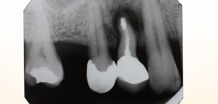 Digital-Dental-Radiology4