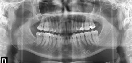 Digital-Dental-Radiology5