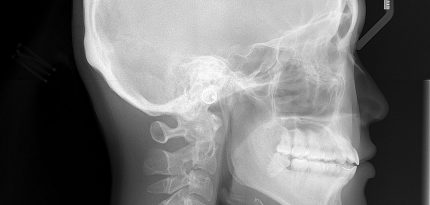 Digital-Dental-Radiology6