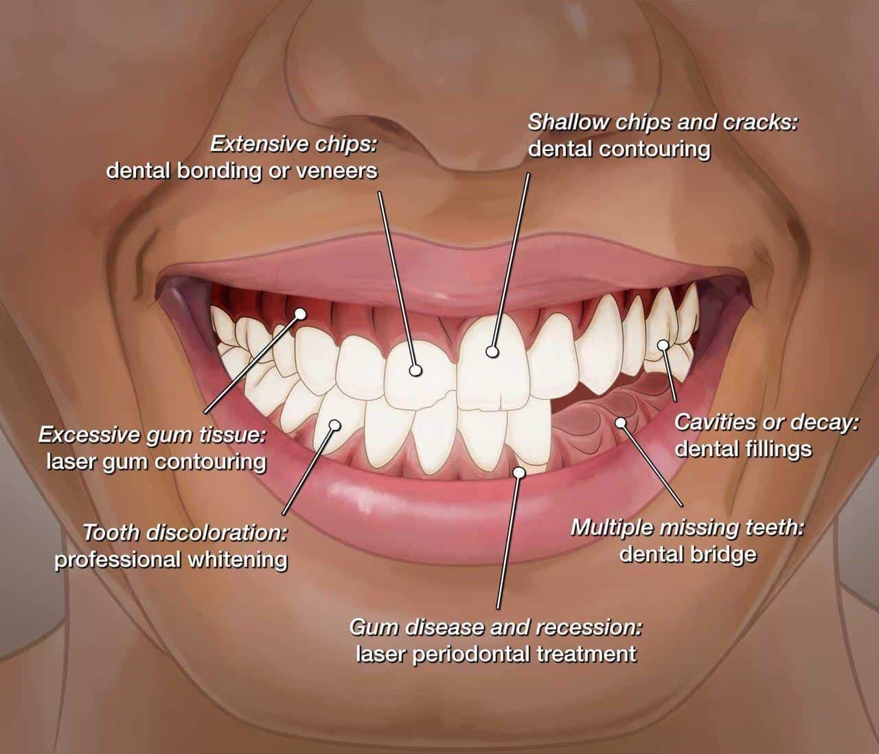 smile-makeovers-digital-smile-design-elite-dental-group