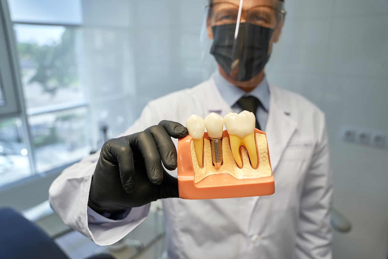 dental implant surgeon in Singapore