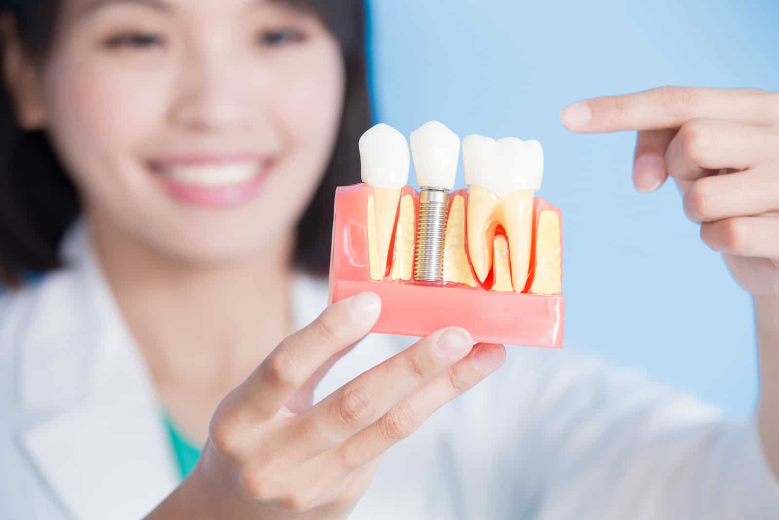 dental implant surgeon in Singapore